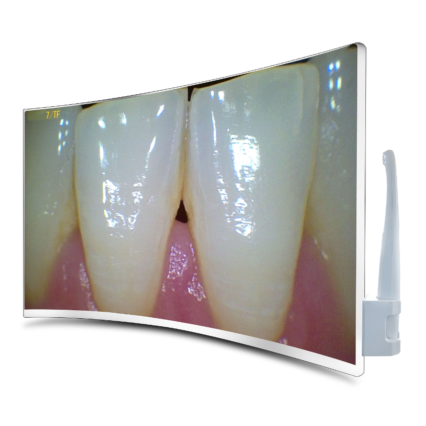 1 23.8 Inch Curved Screen High Resolution Ultra Thin Intraoral Camera